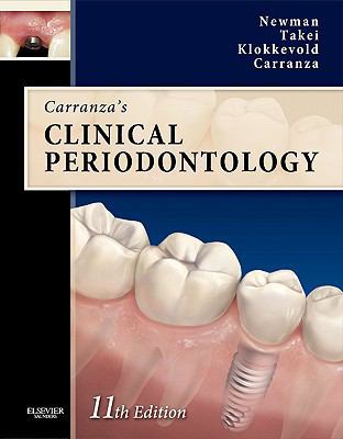Carranza's Clinical Periodontology Expert Consu... 1437704166 Book Cover