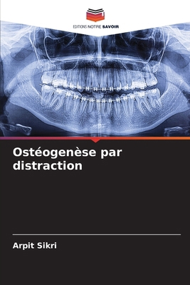 Ostéogenèse par distraction [French] 620787644X Book Cover
