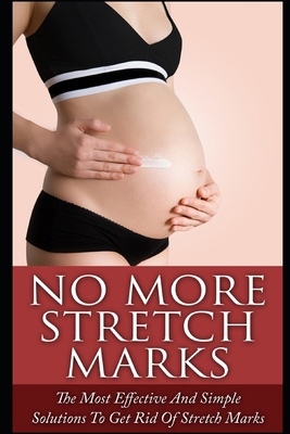 No More Stretch Marks: The Most Effective and S... 1973128233 Book Cover