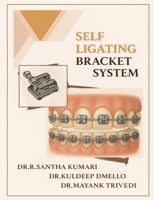 Self Ligating Bracket System B0FH2YPNQ3 Book Cover