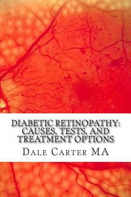 Diabetic Retinopathy: Causes, Tests, and Treatm... 1477447628 Book Cover