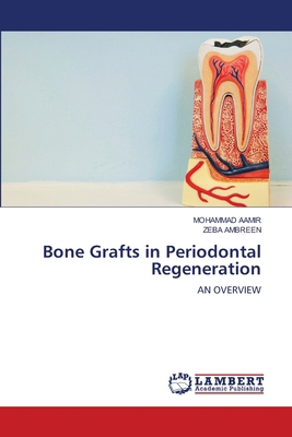 Bone Grafts in Periodontal Regeneration 3330033371 Book Cover