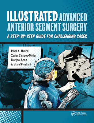 Illustrated Advanced Anterior Segment Surgery: ... 1630911844 Book Cover