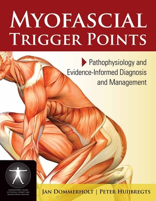Myofascial Trigger Points: Pathophysiology and ... B0074F9VMW Book Cover