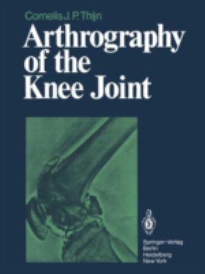 Arthrography of the Knee Joint 3642464009 Book Cover