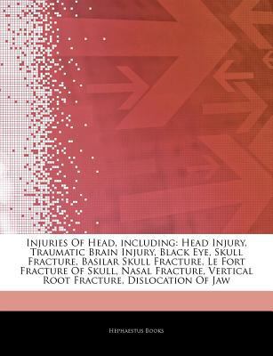 Articles on Injuries of Head, Including : Head Injury, Traumatic Brain Injury, Black Eye, Skull Fracture, Basilar Skull Fracture, le Fort Fracture of S