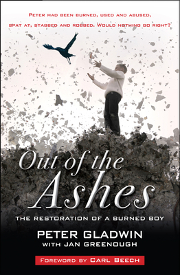 Out of the Ashes: The Restoration of a Burned Boy 1854249924 Book Cover