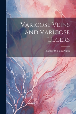Varicose Veins and Varicose Ulcers 1021204382 Book Cover
