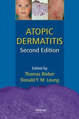 Atopic Dermatitis 1420077988 Book Cover