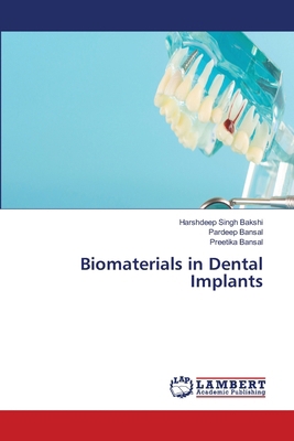 Biomaterials in Dental Implants 6209994946 Book Cover