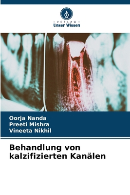 Behandlung von kalzifizierten Kanälen [German] 6208197430 Book Cover