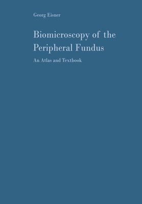Biomicroscopy of the Peripheral Fundus: An Atla... 3642858058 Book Cover