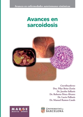 Avances en sarcoidosis [Spanish] 8417903348 Book Cover