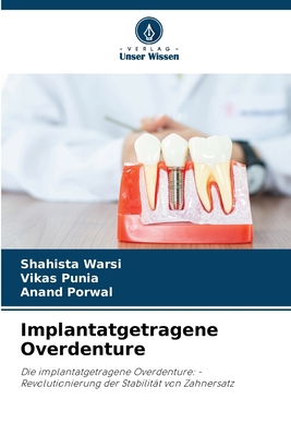 Implantatgetragene Overdenture [German] 6209230261 Book Cover
