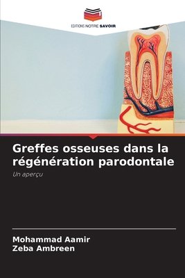Greffes osseuses dans la régénération parodontale [French] 6208634660 Book Cover