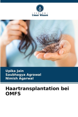 Haartransplantation bei OMFS [German] 6208160391 Book Cover