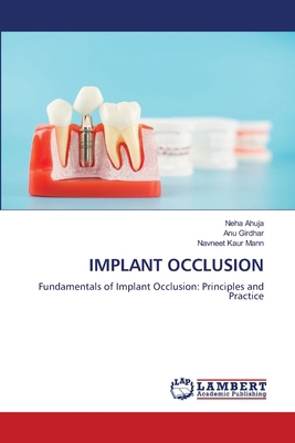 Implant Occlusion 6208427967 Book Cover