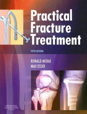 Practical Fracture Treatment 0443068763 Book Cover