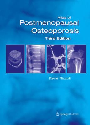 Atlas of Postmenopausal Osteoporosis: Third Edi... 1858734436 Book Cover
