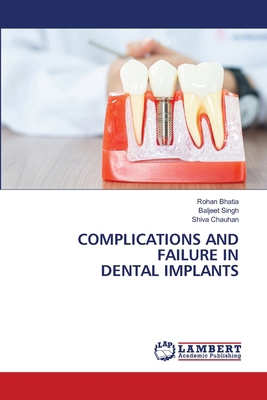 Complications and Failure in Dental Implants 6208117186 Book Cover