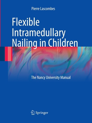 Flexible Intramedullary Nailing in Children: Th... 3662502321 Book Cover