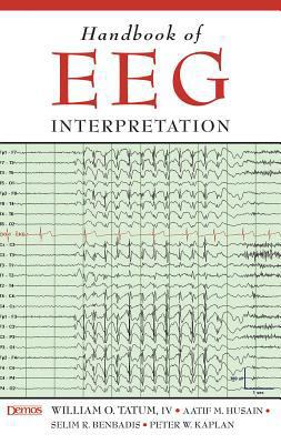 Handbook of EEG Interpretation 1933864117 Book Cover