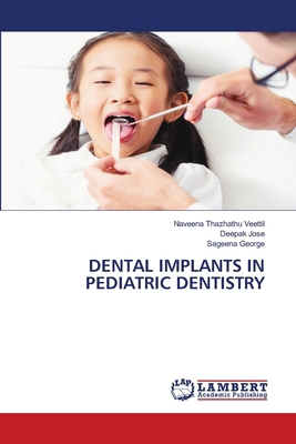 Dental Implants in Pediatric Dentistry 6208424690 Book Cover