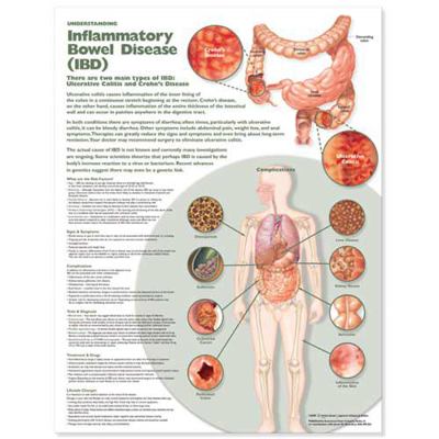 Understanding Inflammatory Bowel Disease (Ibd) ... 0781786495 Book Cover