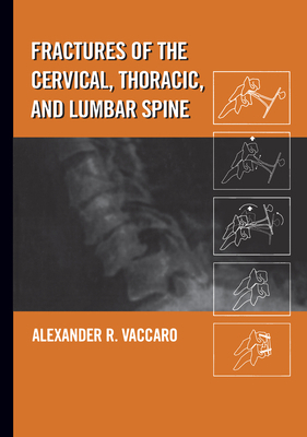 Fractures of the Cervical, Thoracic, and Lumbar... 0824707133 Book Cover