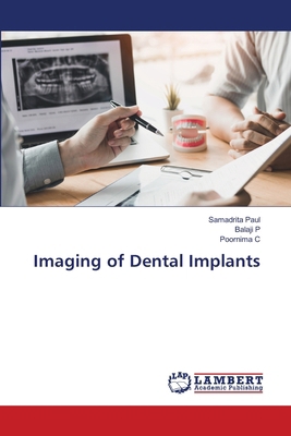 Imaging of Dental Implants 620765420X Book Cover