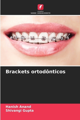 Brackets ortodônticos [Portuguese] 6209053661 Book Cover