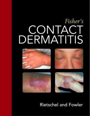 Fisher's Contact Dermatitis B0082PP3UM Book Cover