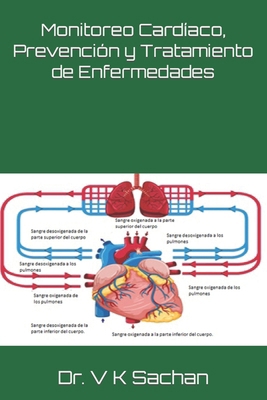 Monitoreo Cardíaco, Prevención y Tratamiento de... [Spanish] B0CM35QMSC Book Cover