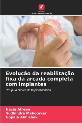 Evolução da reabilitação fixa da arcada complet... [Portuguese] 6206615529 Book Cover