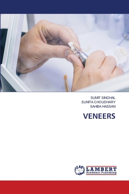 Veneers 3659393363 Book Cover