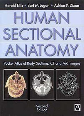 Human Sectional Anatomy: Pocket Atlas of Body S... 0340807644 Book Cover