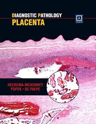 Diagnostic Pathology: Placenta 1937242226 Book Cover