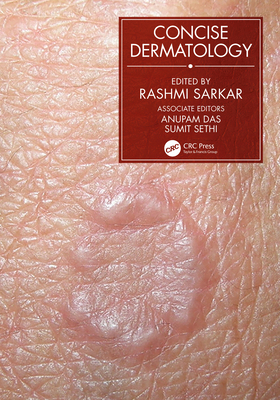 Concise Dermatology 0367533650 Book Cover