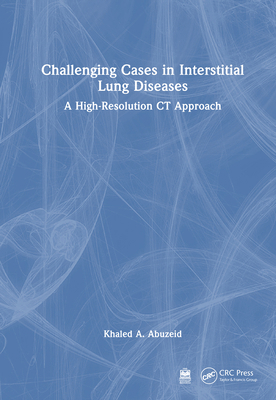 Challenging Cases in Interstitial Lung Diseases... 1032950048 Book Cover