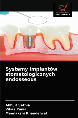 Systemy implantów stomatologicznych endosseous [Polish] 6203507490 Book Cover