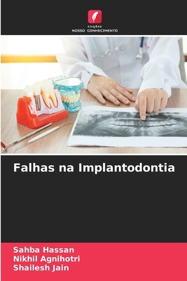 Falhas na Implantodontia [Portuguese] 6208285984 Book Cover