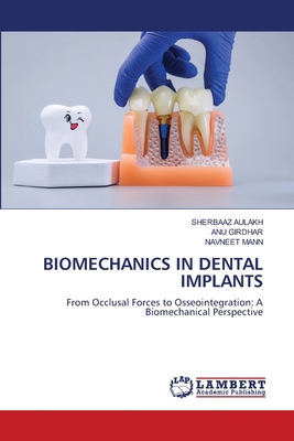 Biomechanics in Dental Implants 663043949X Book Cover