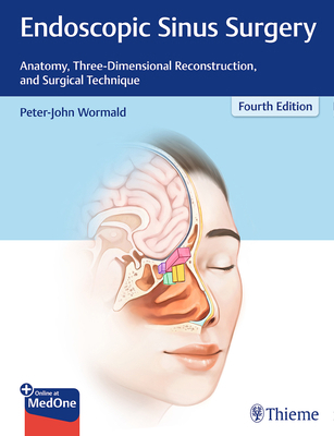 Endoscopic Sinus Surgery: Anatomy, Three-Dimens... 1626234698 Book Cover