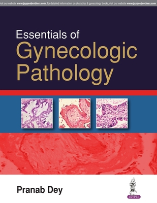 Essentials of Gynecologic Pathology 9386261200 Book Cover