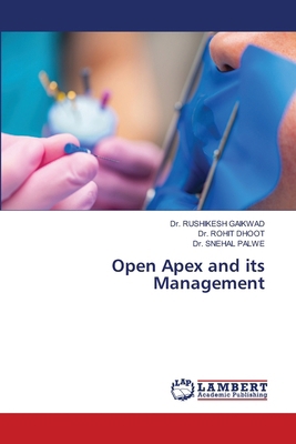 Open Apex and its Management 620806354X Book Cover