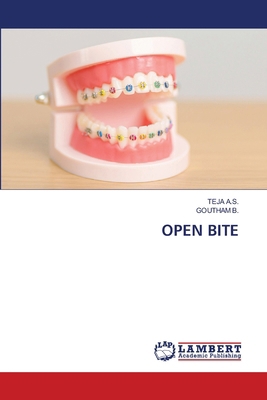 Open Bite 6208442257 Book Cover