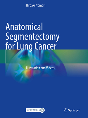 Anatomical Segmentectomy for Lung Cancer: Illus... 9819958598 Book Cover