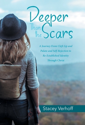 Deeper Than the Scars: A Journey from Cleft Lip... 1973690330 Book Cover