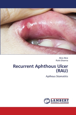 Recurrent Aphthous Ulcer (RAU) 6207461339 Book Cover