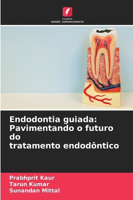 Endodontia guiada: Pavimentando o futuro do tra... [Portuguese] 6208192668 Book Cover